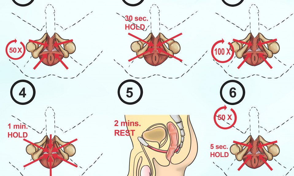 exercice pc kegel